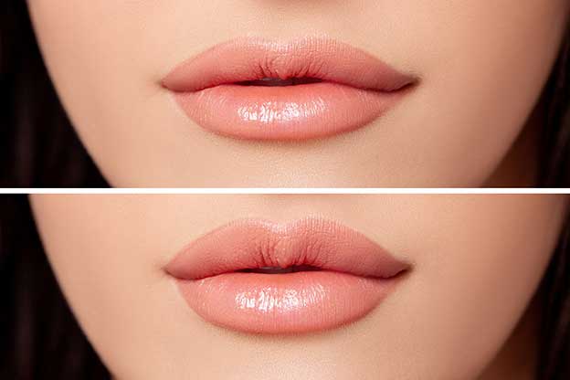 Natural Size and Shape of Lips